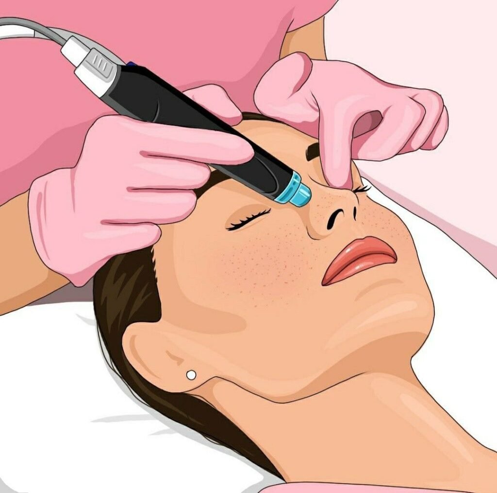 Microneedling